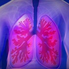 Longembolie: Afsluiting van slagader in longen