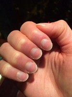 Half and half nails of Lindsay's nails / Bron: Nickyay, Wikimedia Commons (CC BY-SA-4.0)